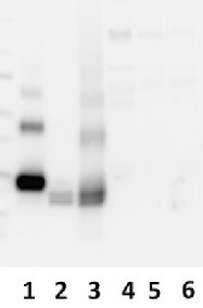 AMBP | Bikunin (50 ĩl) in the group Antibodies Human Cell Biology / Other proteins at Agrisera AB (Antibodies for research) (AS06 173)